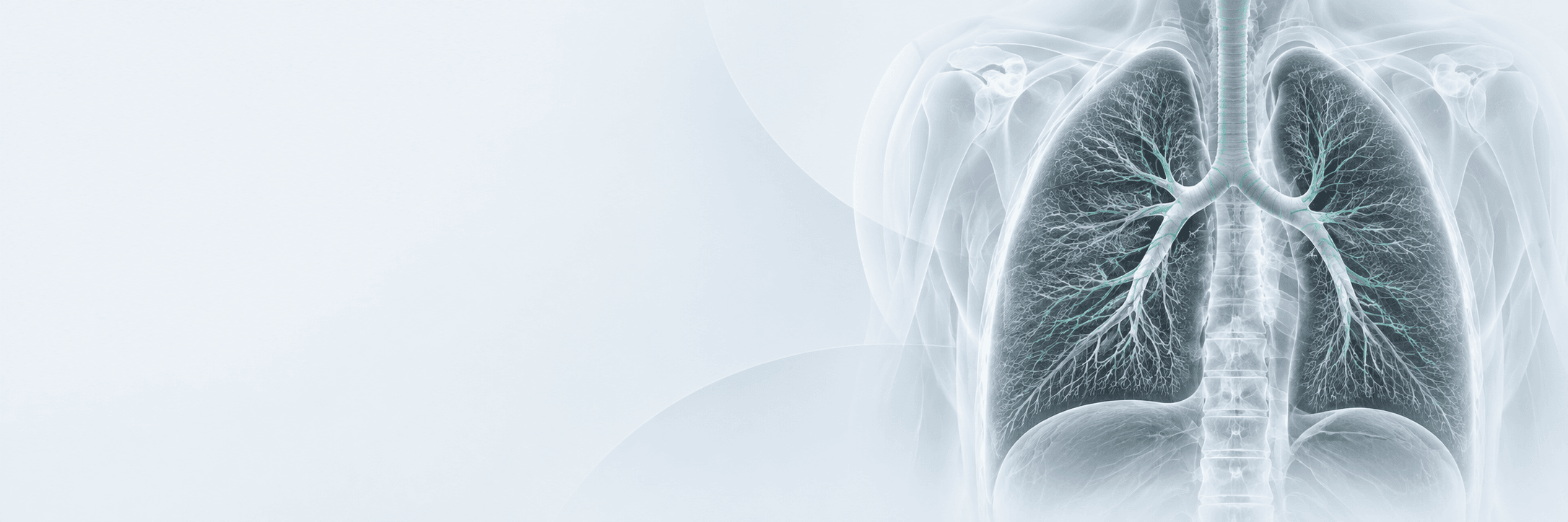 Lungenkrebsscreening mittels Niedrigdosis-CT